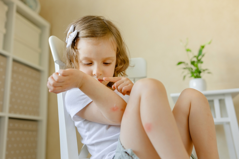 little girl with bug bites on leg and arm